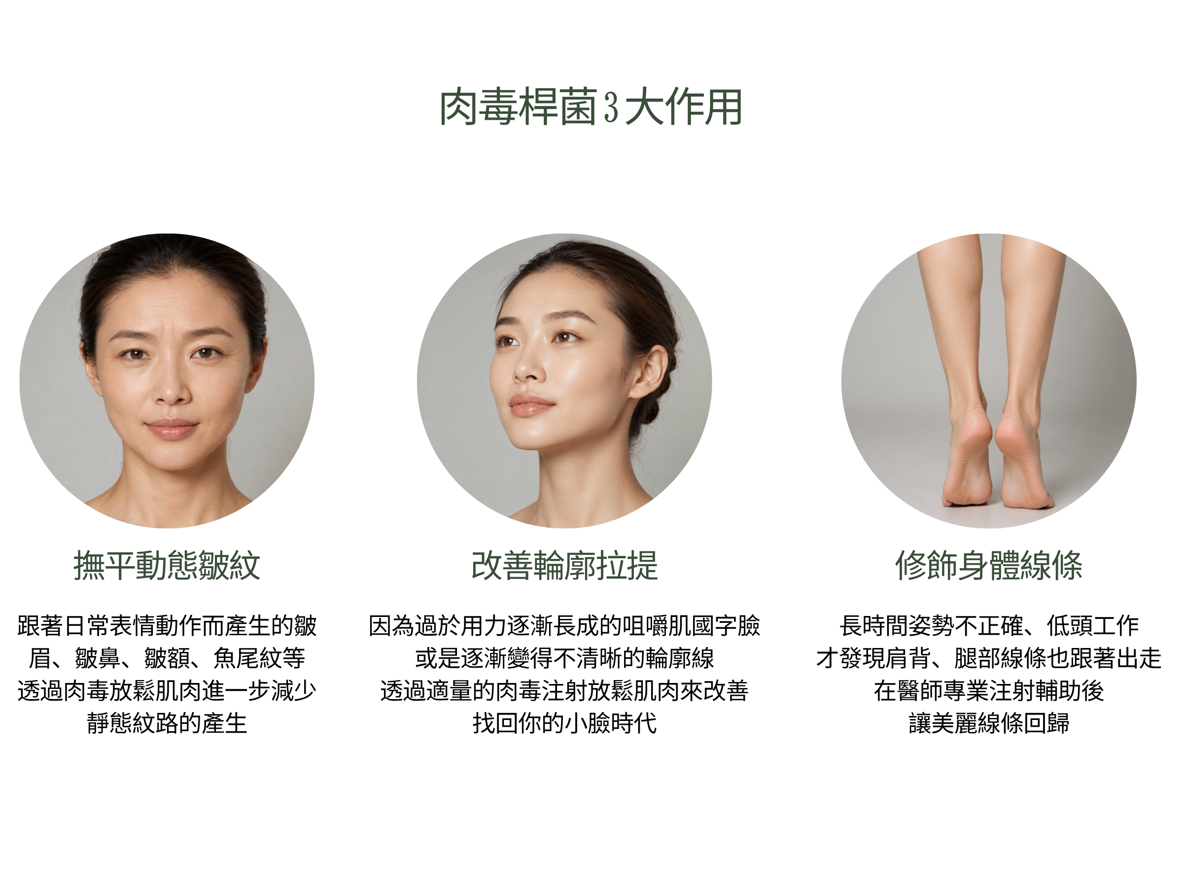 肉毒桿菌可以改善哪些問題? 動態皺紋|抬頭紋、魚尾紋、皺眉紋 「動態皺紋」是指當臉部有表情活動時,才會出現的紋路。例如:笑到眼睛瞇起來、眼周產生的魚尾紋,或是額頭用力產生的抬頭紋,就適合用肉毒桿菌素注射放鬆肌肉,治療後約莫一週就會有明顯的改善。 國字臉、磨牙|咀嚼肌放鬆 國字臉或是磨牙問題,可能來自於咀嚼肌重複無意識地用力所引起。注射肉毒桿菌能讓咀嚼肌放鬆,不但能夠改變國字臉形外觀,也可以改善磨牙問題。 蘿蔔腿、虎背|身形線條修飾 肌肉發達的小腿或是寬厚的肩膀,也能透過注射肉毒桿菌獲得改善,讓線條更加柔和勻稱。